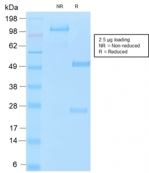 MUC16 Antibody
