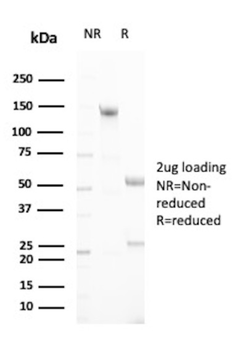 MUC16 Antibody