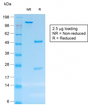 TNFRSF8 Antibody