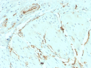 CD34 Antibody