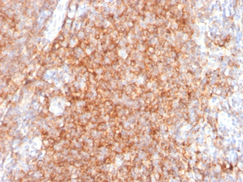 CD40 Antibody