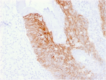 CD44 Antibody
