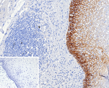 CD44 Antibody