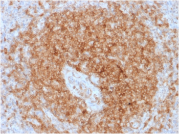 CD79A Antibody