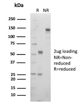 CD79A Antibody