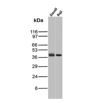 CD79A Antibody