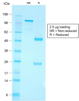 CD79A Antibody