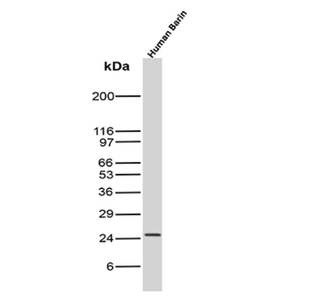 CD81 Antibody