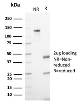 CD81 Antibody