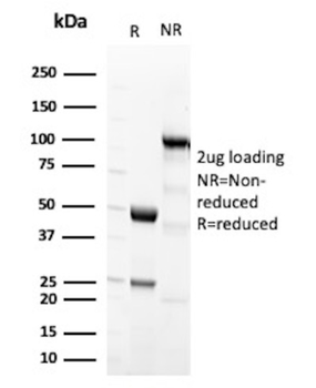 MVP Antibody
