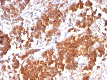 TNFSF15 Antibody