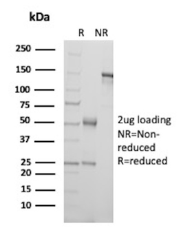 TNFSF15 Antibody