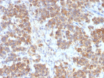 TNFSF15 Antibody