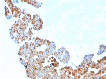CDC34 Antibody