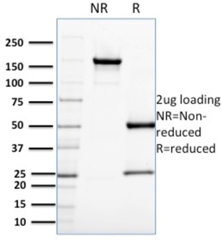 CDC34 Antibody