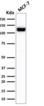 CDH1 Antibody