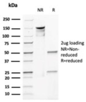 CDH1 Antibody