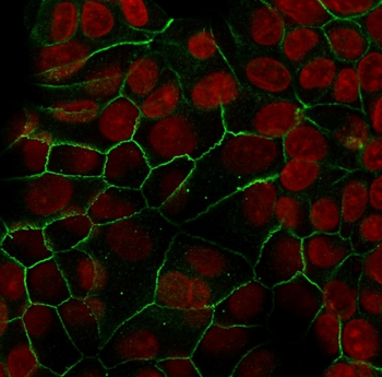 CDH1 Antibody