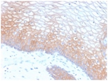 CDH1 Antibody