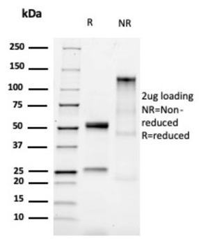 CDH1 Antibody