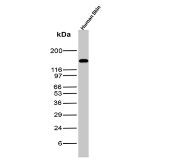 CDH1 Antibody
