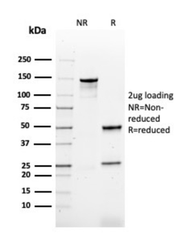 Recombinant HPV-16 (Human Papilloma Virus 16) Antibody
