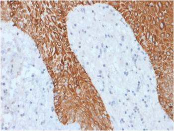 KRT6A Antibody