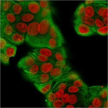 KRT6A Antibody