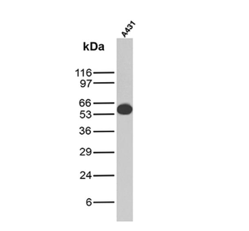 KRT6A Antibody