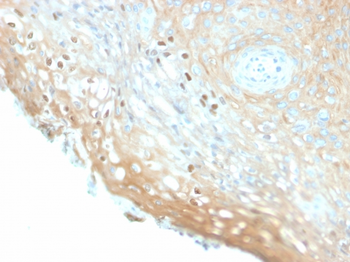 Recombinant HPV-16 (Human Papilloma Virus 16) Antibody