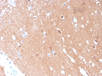 TUBB3 Antibody
