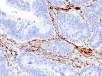 NES Antibody