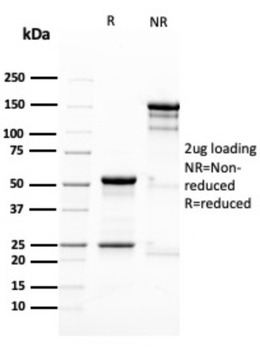 NES Antibody