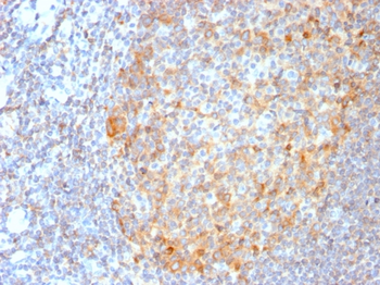 MALT1 Antibody