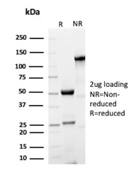 MALT1 Antibody