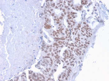 CHD4 Antibody
