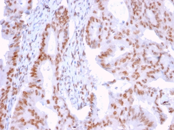 DMC1 Antibody