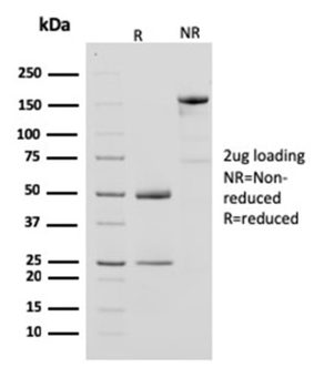 CKB Antibody