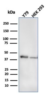 CKB Antibody