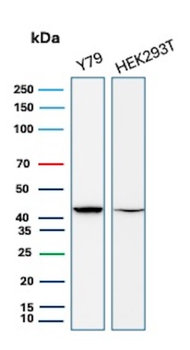 CKB Antibody