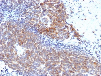 TOP1MT Antibody