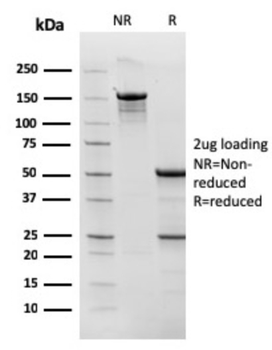 TOP1MT Antibody