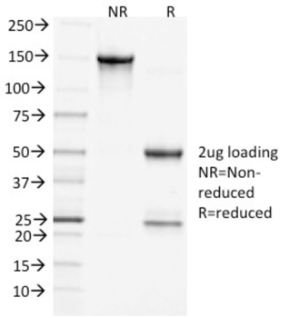 CLTCL1 Antibody