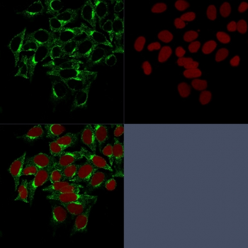 CLTCL1 Antibody