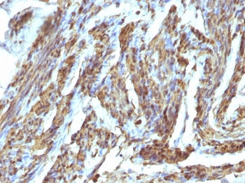 CNN1 Antibody