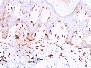 COL7A1 Antibody