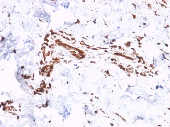 COL7A1 Antibody