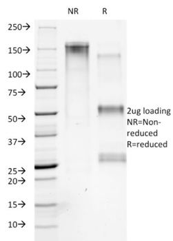COL7A1 Antibody