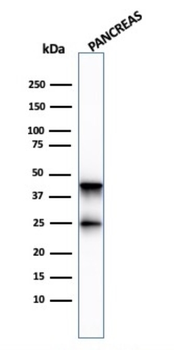 CPA1 Antibody