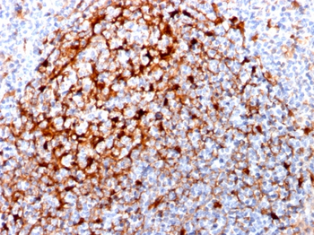 CSTA Antibody